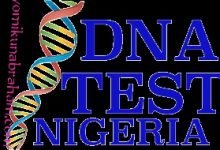 Cost of DNA test in Nigeria